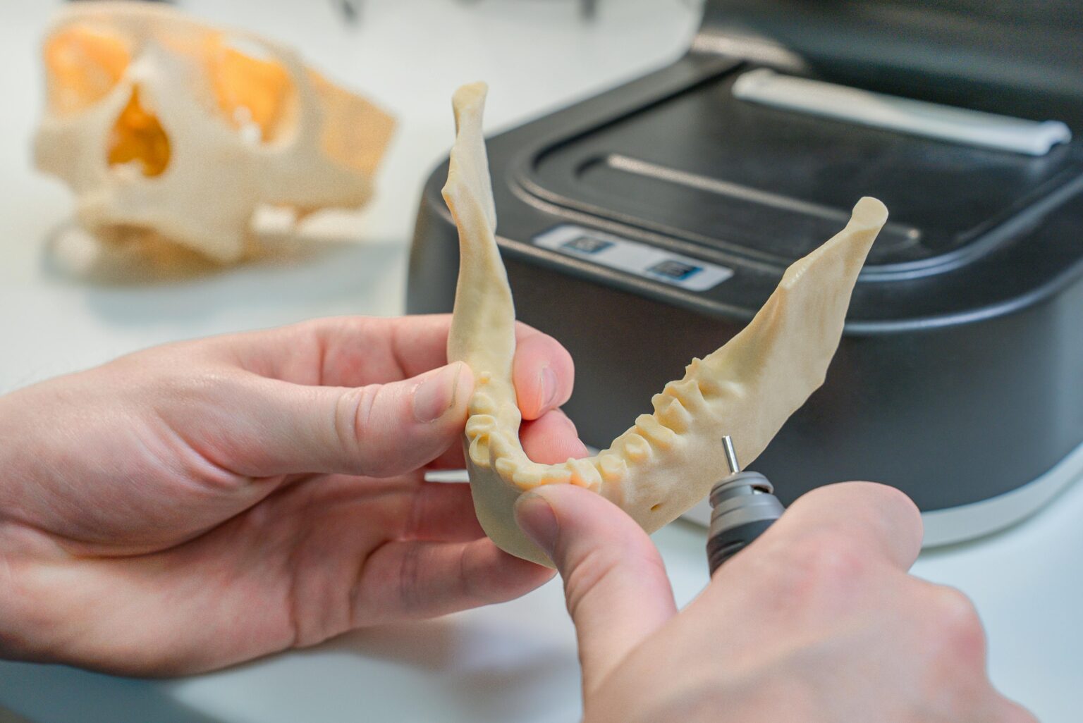 The Comfort Full Dental Implants Can Bring to Your Daily Life